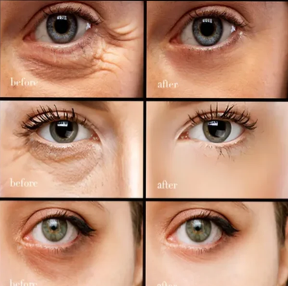 (🔥Vásárolj 1-et, kapsz 2-t ingyen🔥) Koffeines szemkörnyékápoló krém